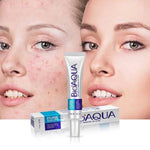 BioAqua Pure Skin - El Mejor Tratamiento Anti Acné